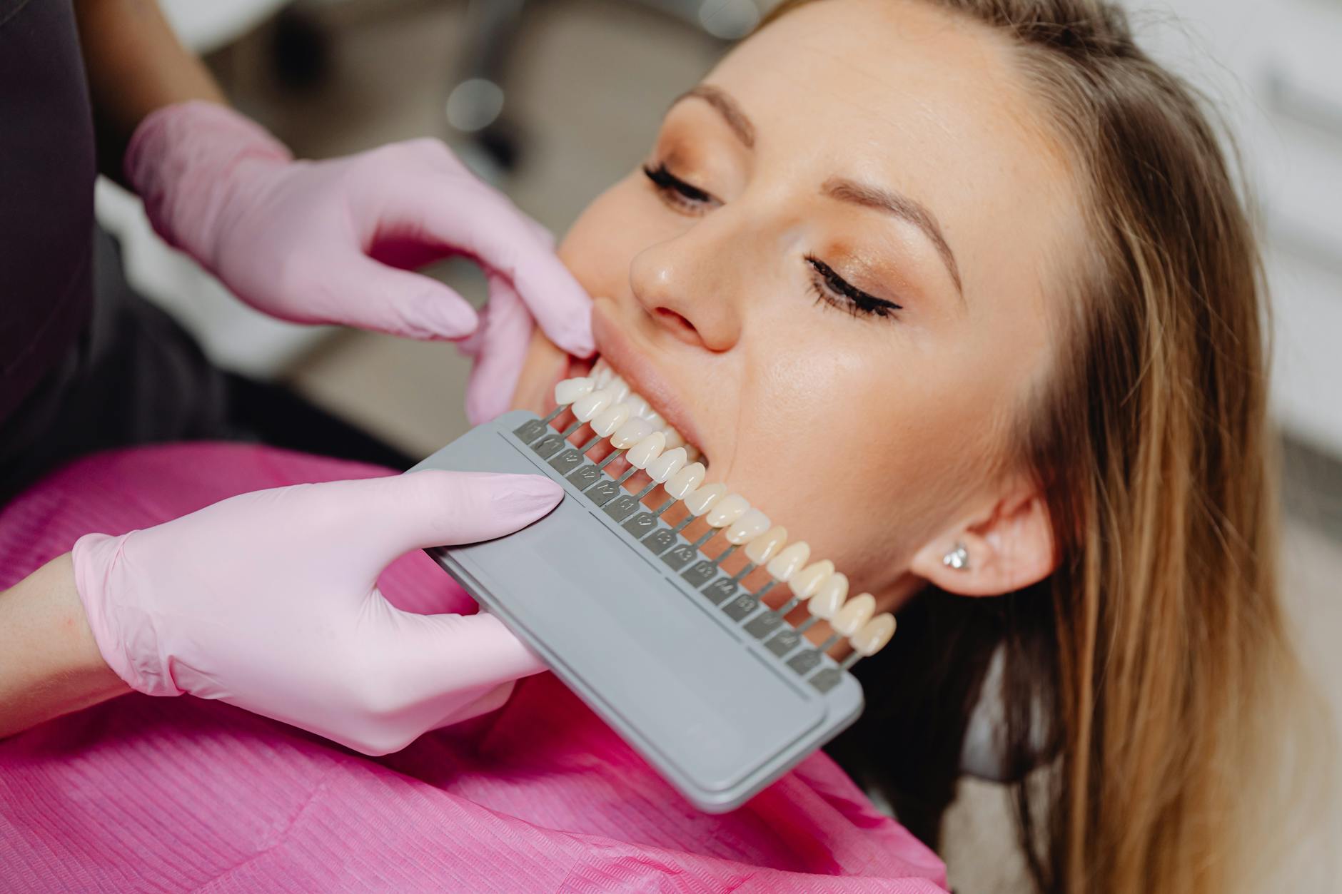 How Different Whitening Locations Affect Your Grade