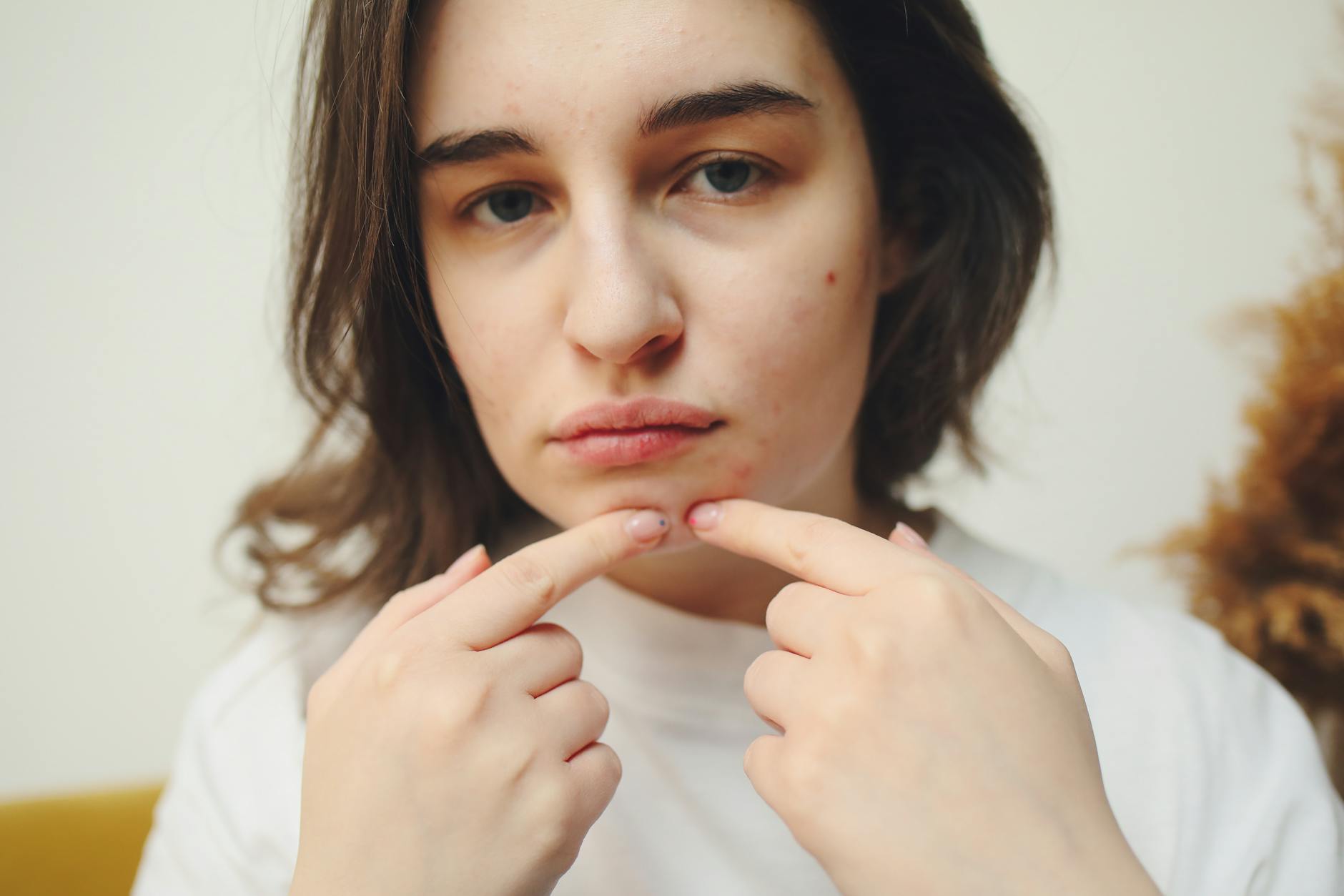 The Domino Effect of Minor Imperfections